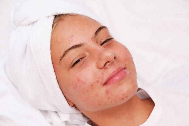 Hormones & Skin Health
