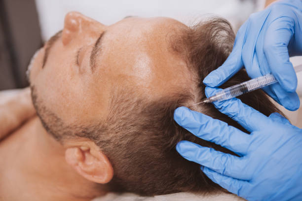 Platelet Rich Plasma
